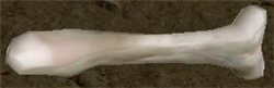 Bone