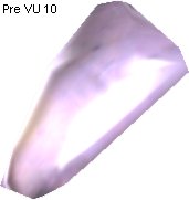 Metallic Bone Replacement