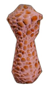 Trabecular Augmented